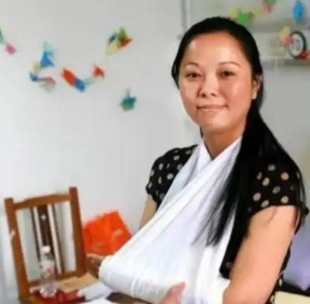 2011年杭州，2岁女童从10楼坠落，一女子徒手接住，左臂当场断成三截。后来她获