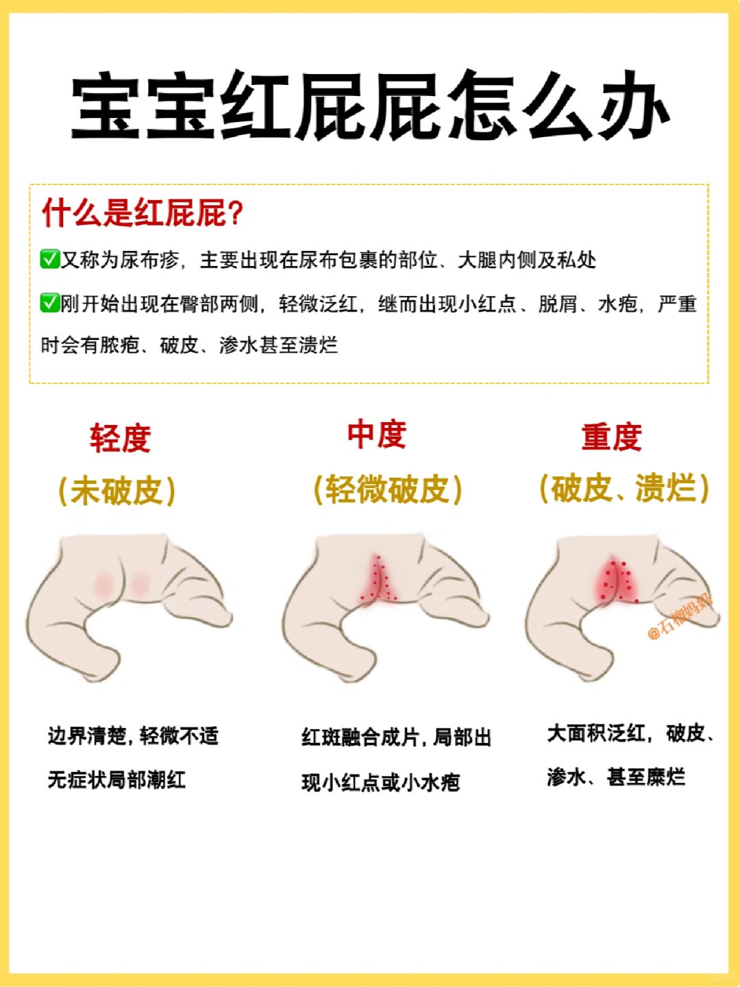 宝宝红屁屁怎么处理？新手爸妈赶紧码住！