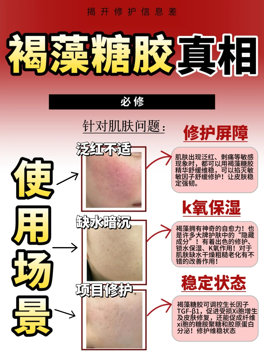 红敏烂脸大脆皮猛猛用！这瓶包稳的