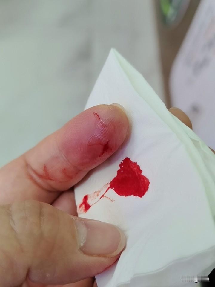 善良给你带来了什么善良给我最大的就是伤害。。。总是受伤[流泪][流泪][流泪][