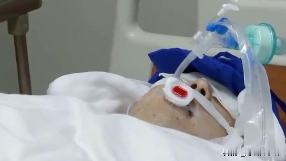 心脏停跳两天，人还能活着走出医院吗？这不是科幻，而是真实发生的生命奇迹。
近日，