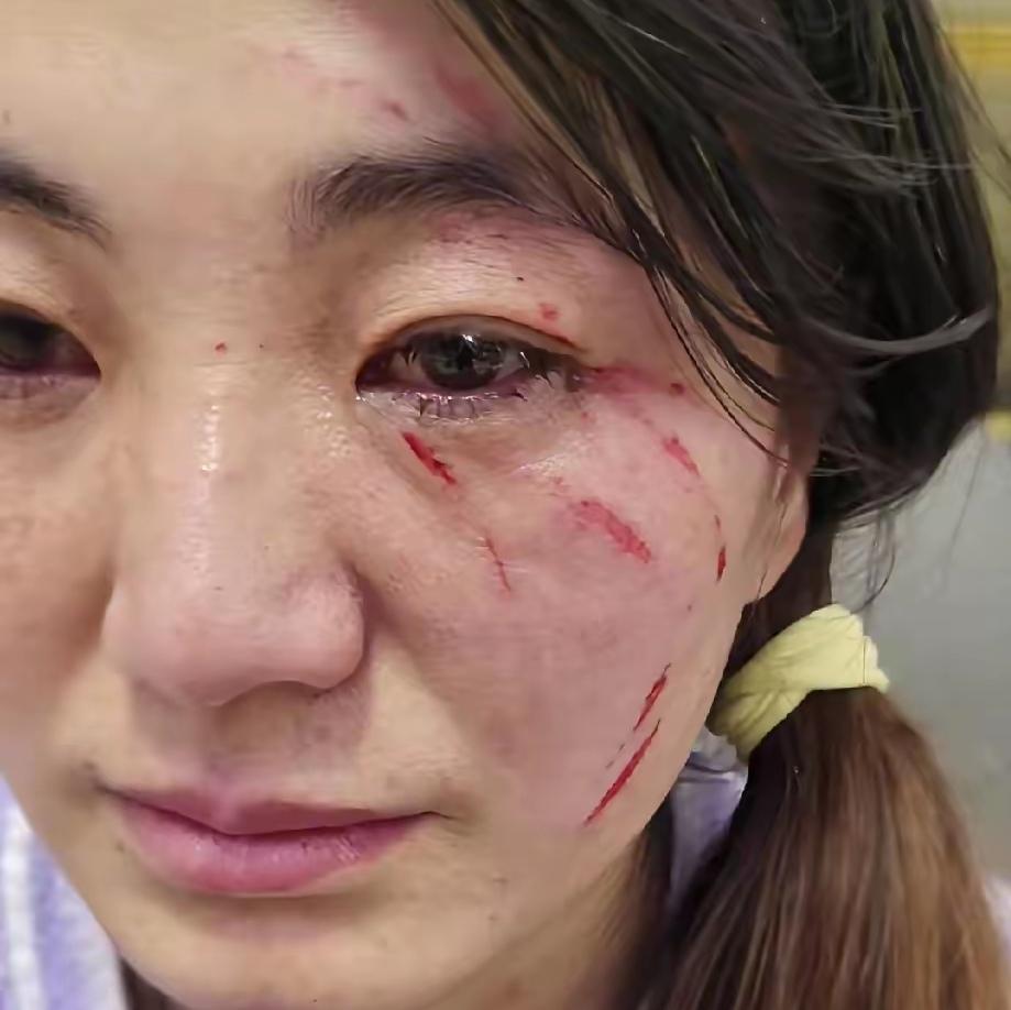 你们能相信吗？我居然被婆婆给破相了！这日子简直没法过了，我现在满心都是委屈和崩溃