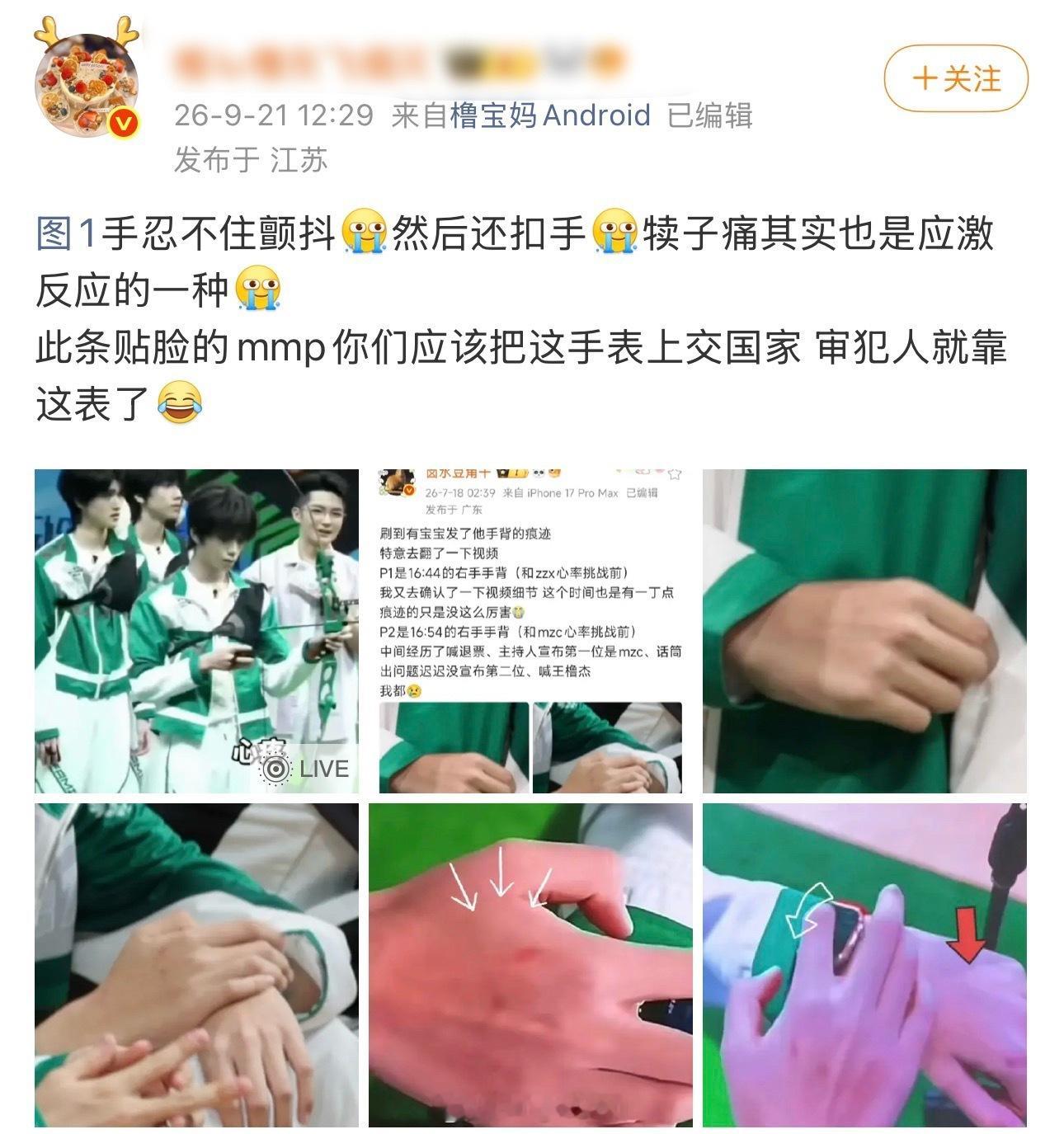 想象一下你担是那种紧张得会兜不住翔的人 ​​​