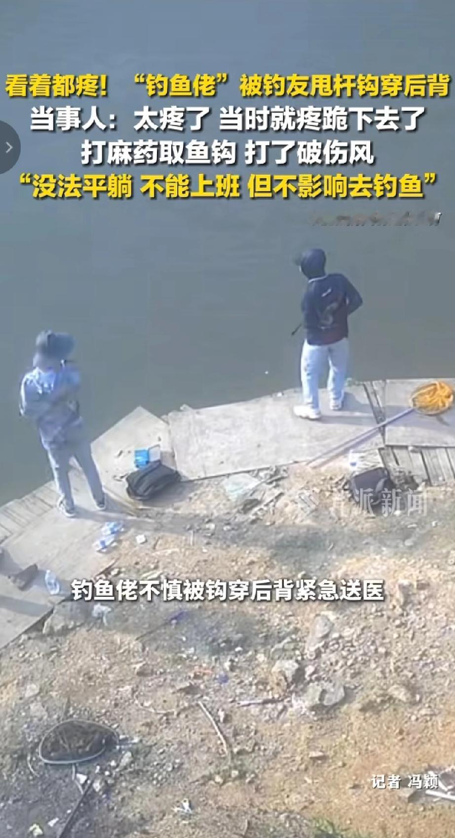 看着都疼！这钓鱼佬被钓友甩杆钩穿后背，也太惨了吧！
当时就疼得跪地上了，打麻药取