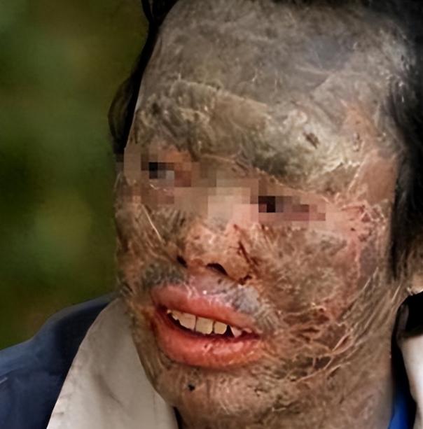 吃蛇太多变蛇人？辽宁村民韩永波爱吃蛇，吃了多年没出事，直到2003年，一条黄花松