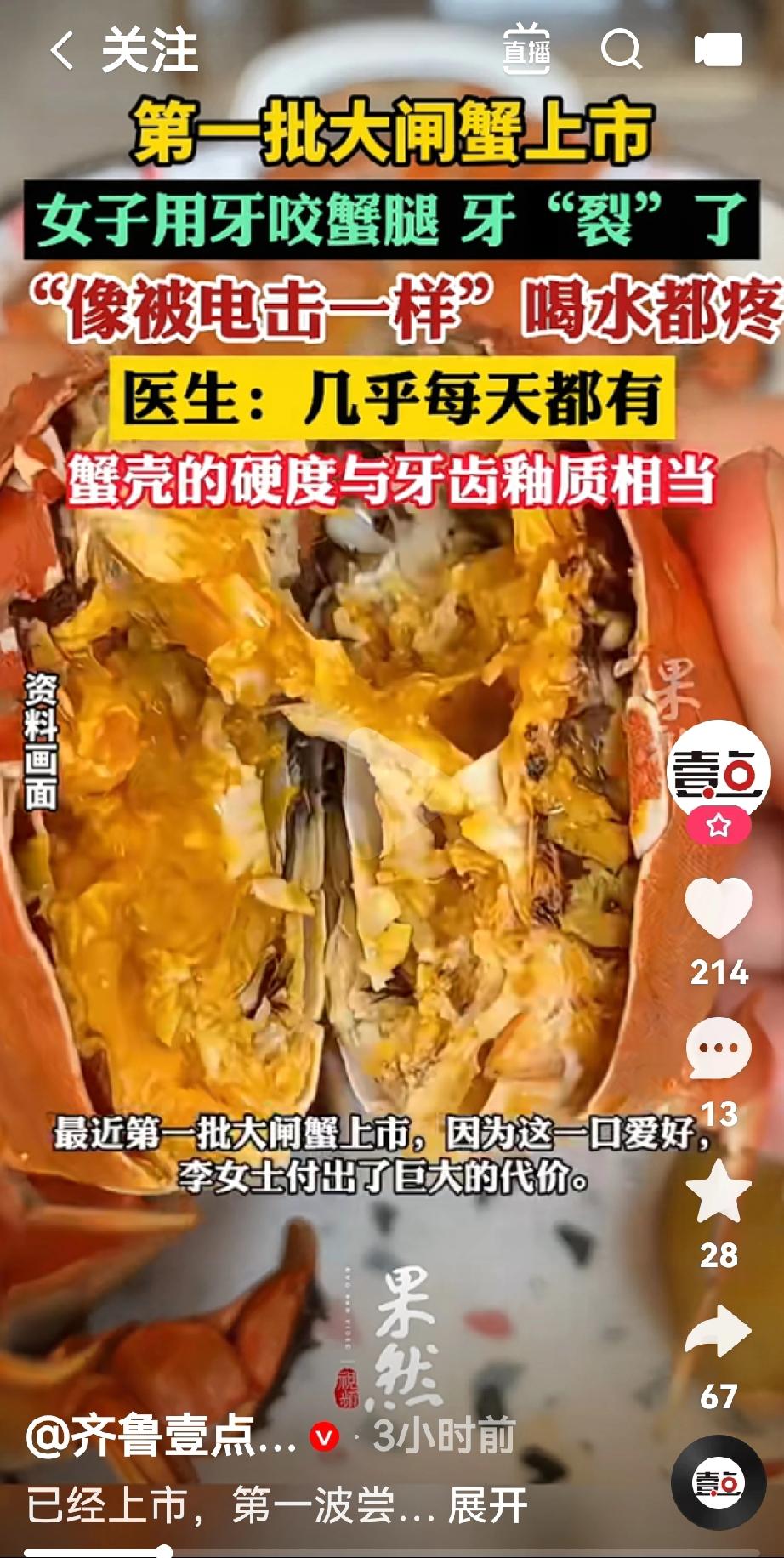 大闸蟹虽好吃，但不要用牙咬
最近第一批大闸蟹上市了，李女士为了吃这一口美味，也付