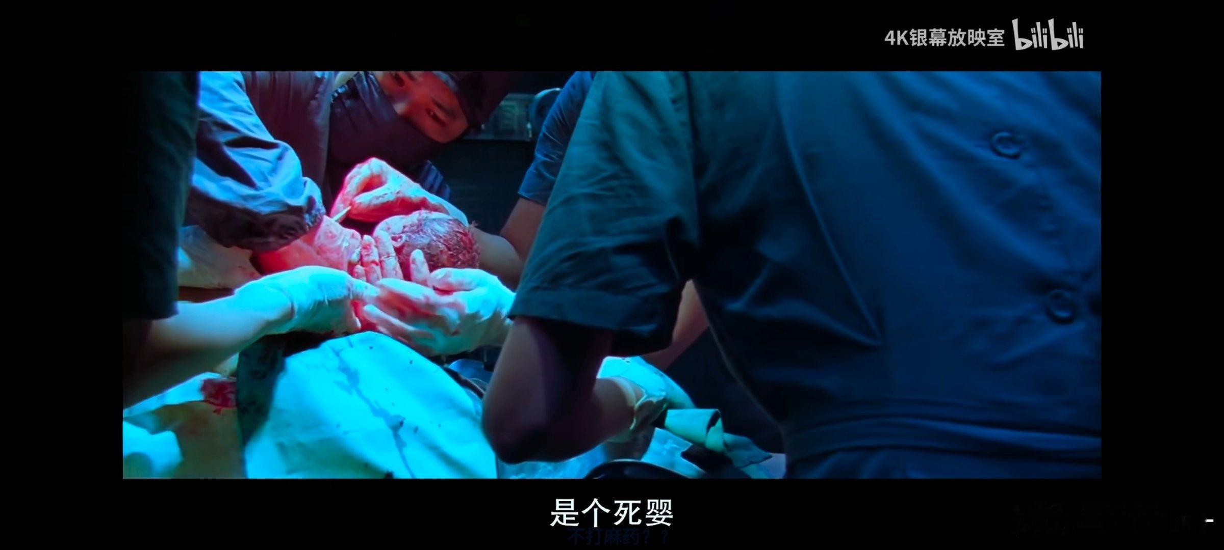 握草.....接生的医生也太敬业了，面无表情说了句是个死婴😐 
