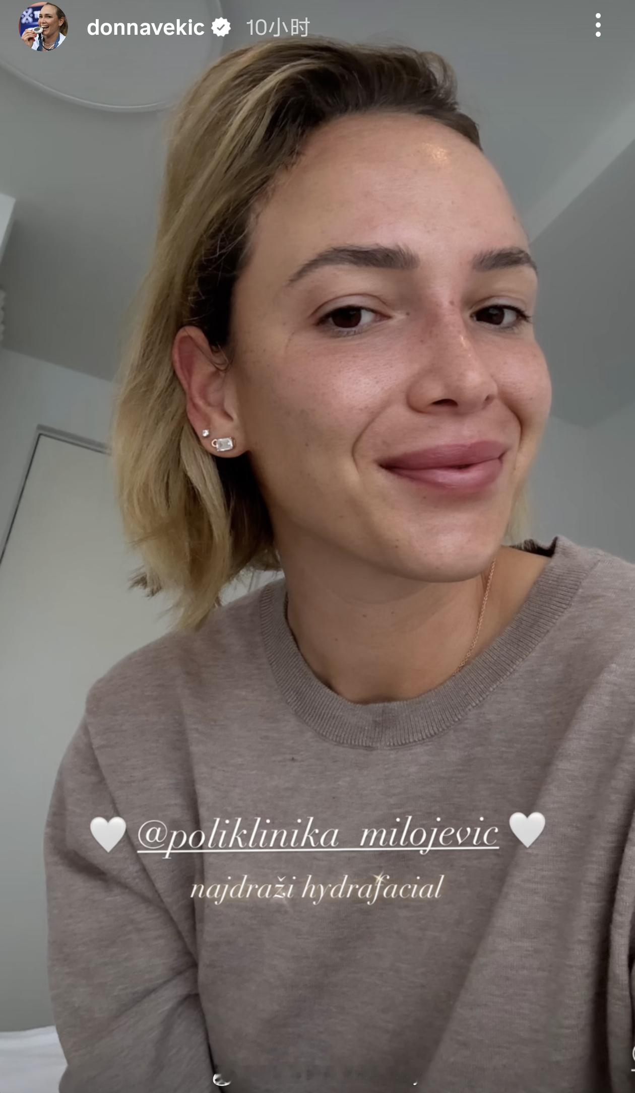 维基奇的素颜妆❓网球talking大会网球