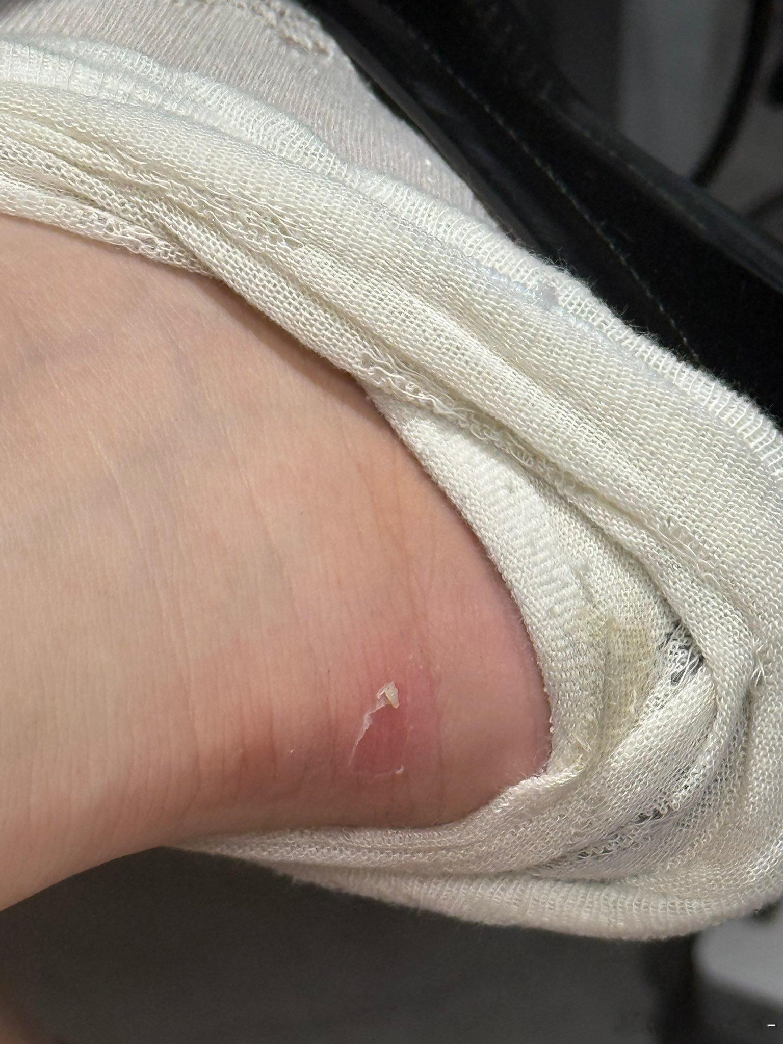 小皮鞋真的嘛容易磨破皮 