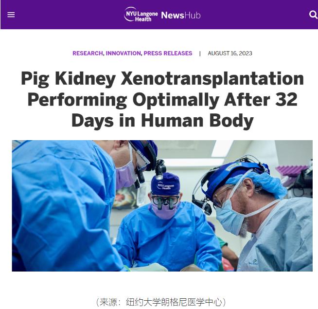 美国的猪肾人体移植试验成功撑过1个月，打破该项实验记录时长
该试验采用的是基因编