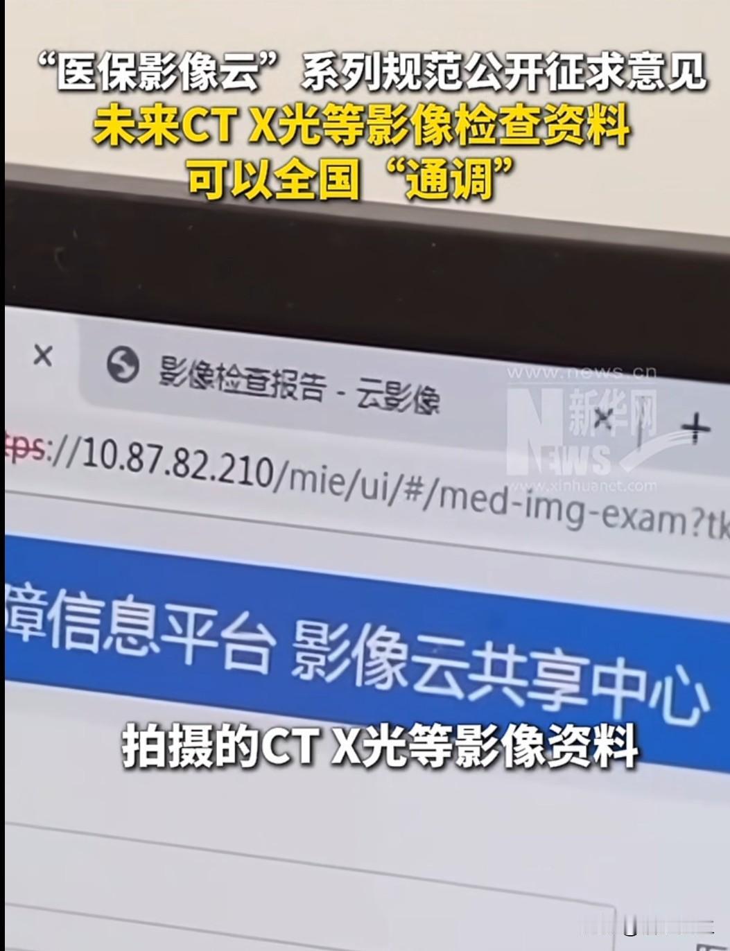 近日，医保局就四项"医保影像云"基础规范公开征求意见，预示着我国医疗数字化进程又