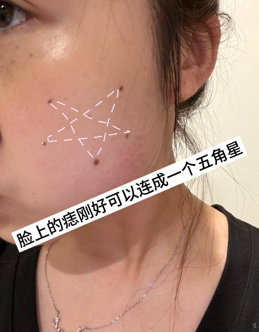 每颗痣都长得刚刚好