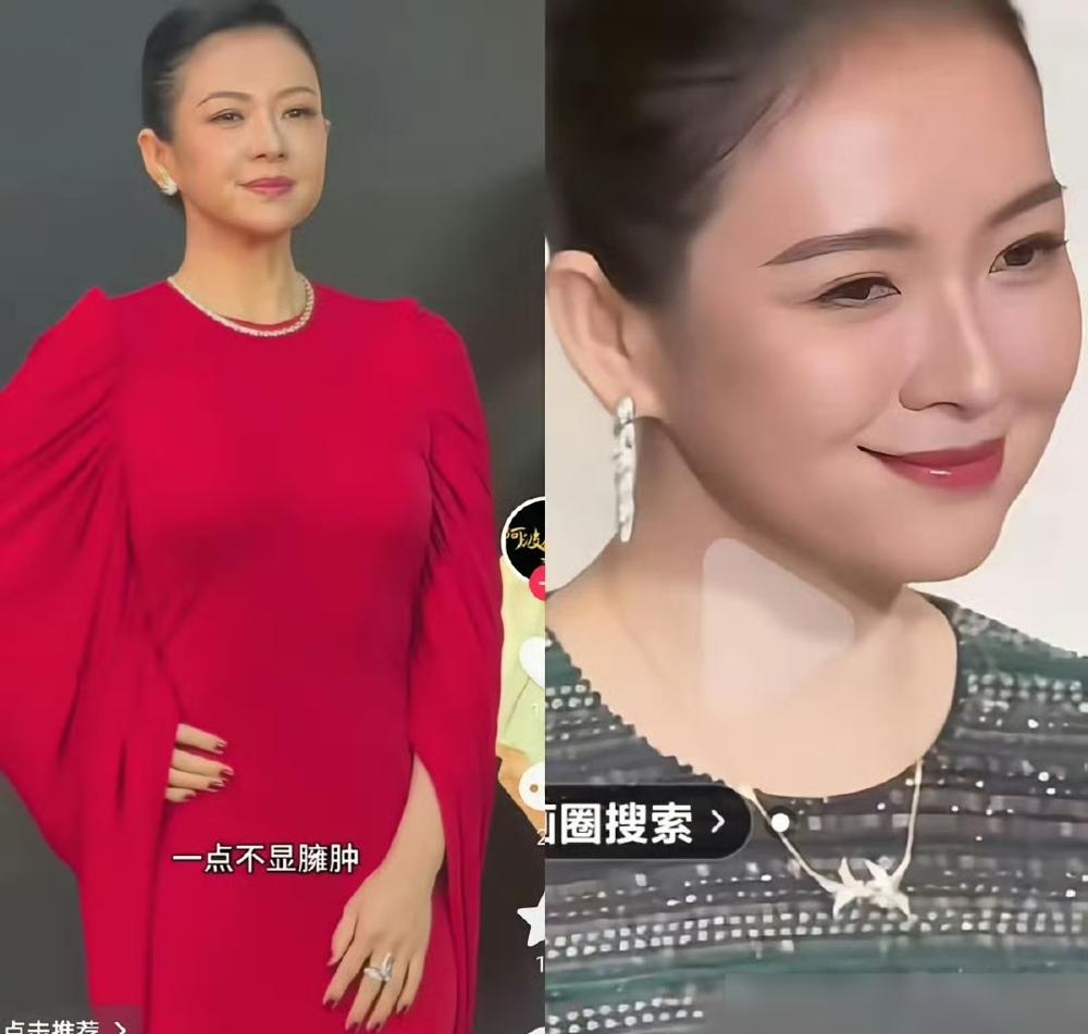 章子怡那张刀削斧凿的脸，怎么一夜之间，被吹成了发面馒头？
 
我跟你说，盛典生图