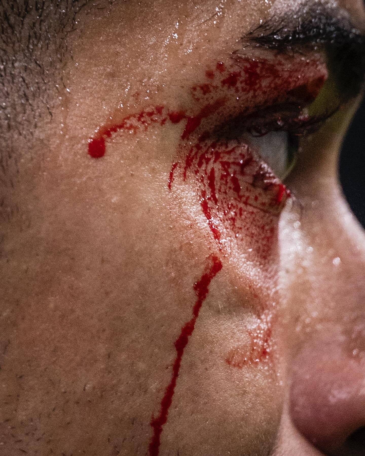 🩸皇马vs塞尔塔