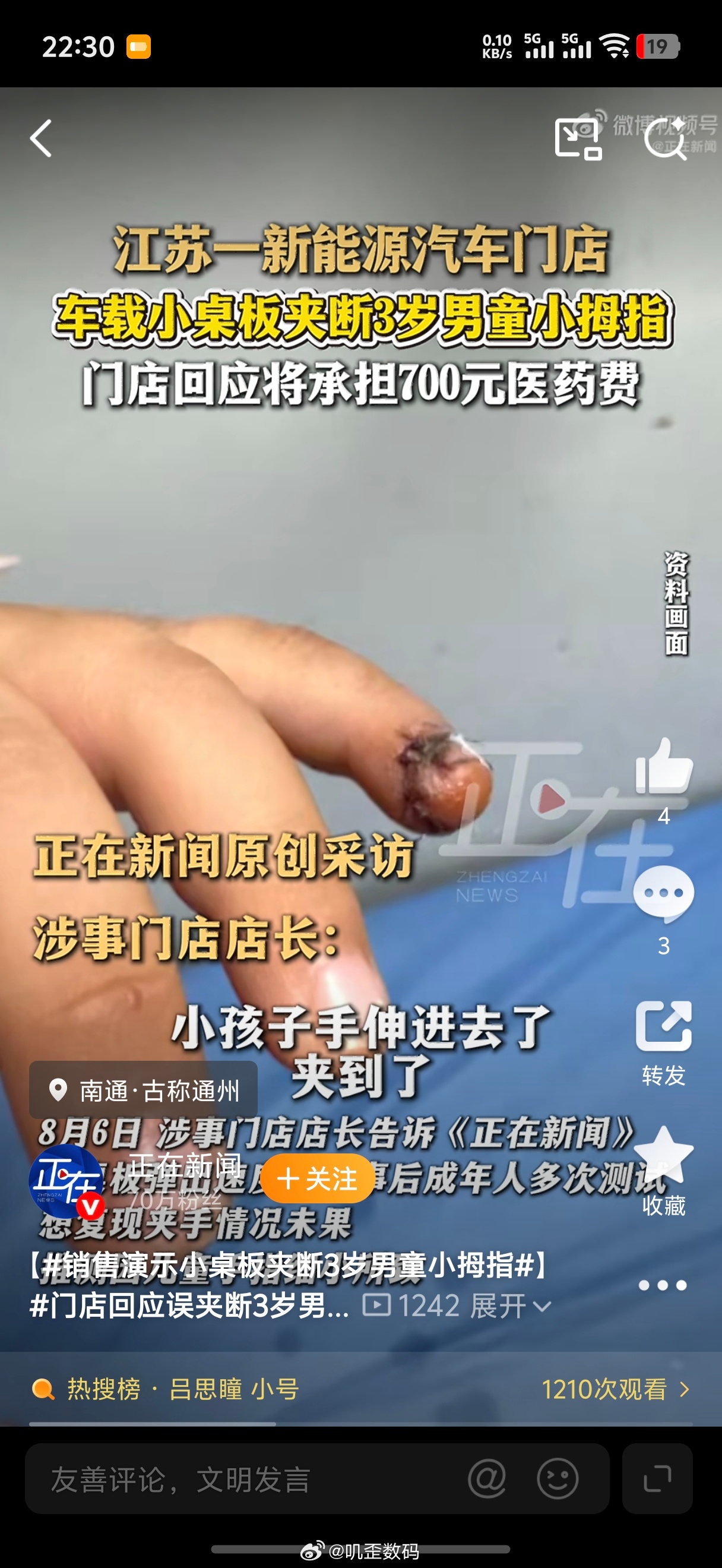 销售演示小桌板夹断3岁男童小拇指这是什么品牌的车啊这么吓人？把小孩的手夹成这样？