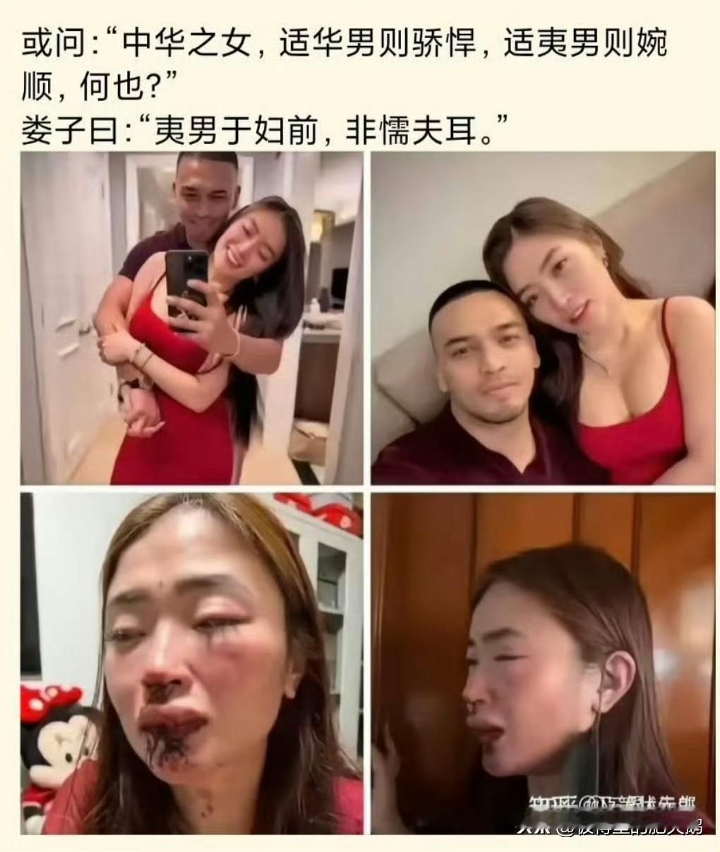 还是西药见效快[皱眉]
挨了老拳也不报警，就自己默默流眼泪。

尽管血淋淋的实例