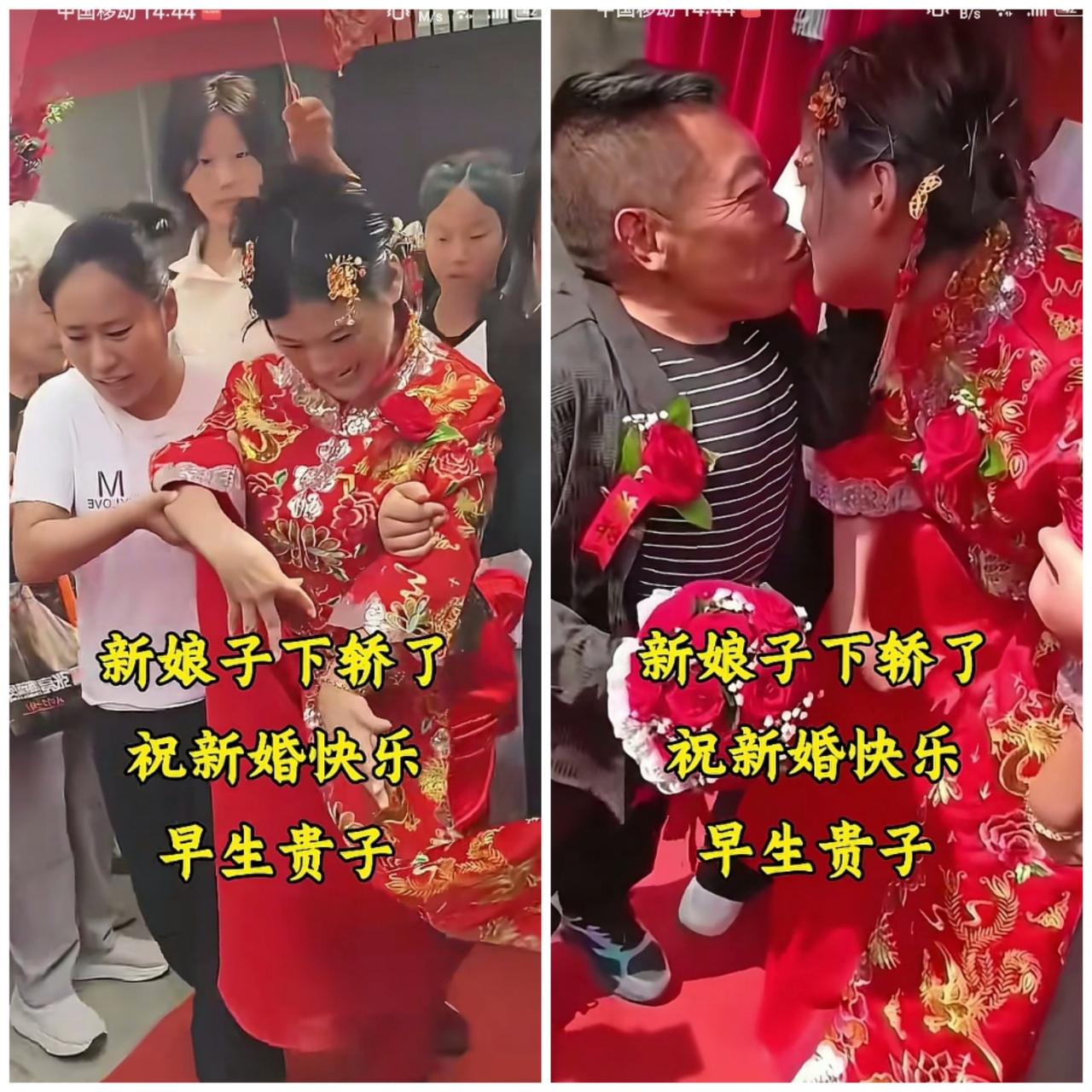 两个都是可怜人，但是这种结合我们还是要支持的。男人侏儒症，年龄大了找不到媳妇。女