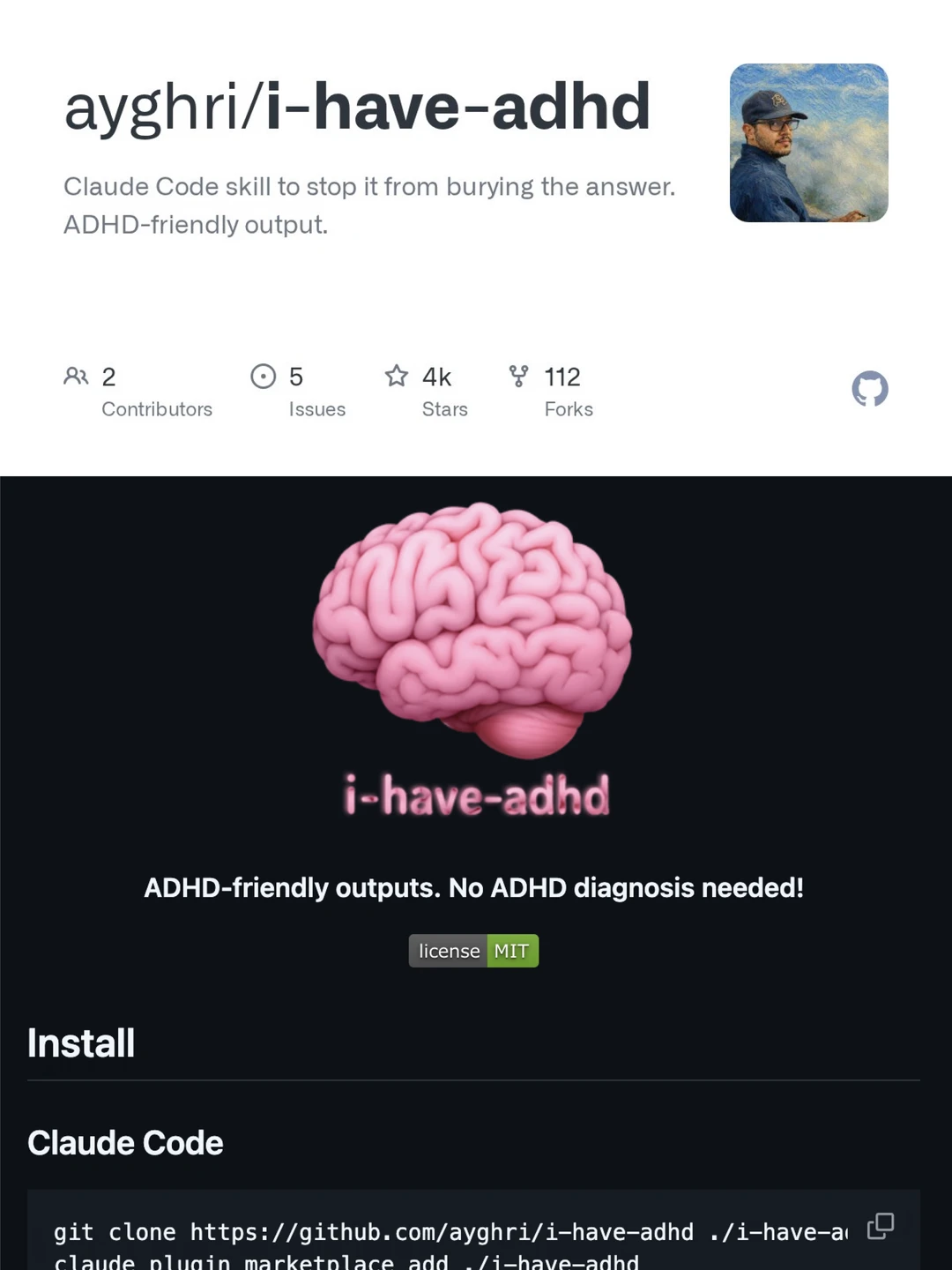 爆火插件！拯救你 ADHD 的救星来了