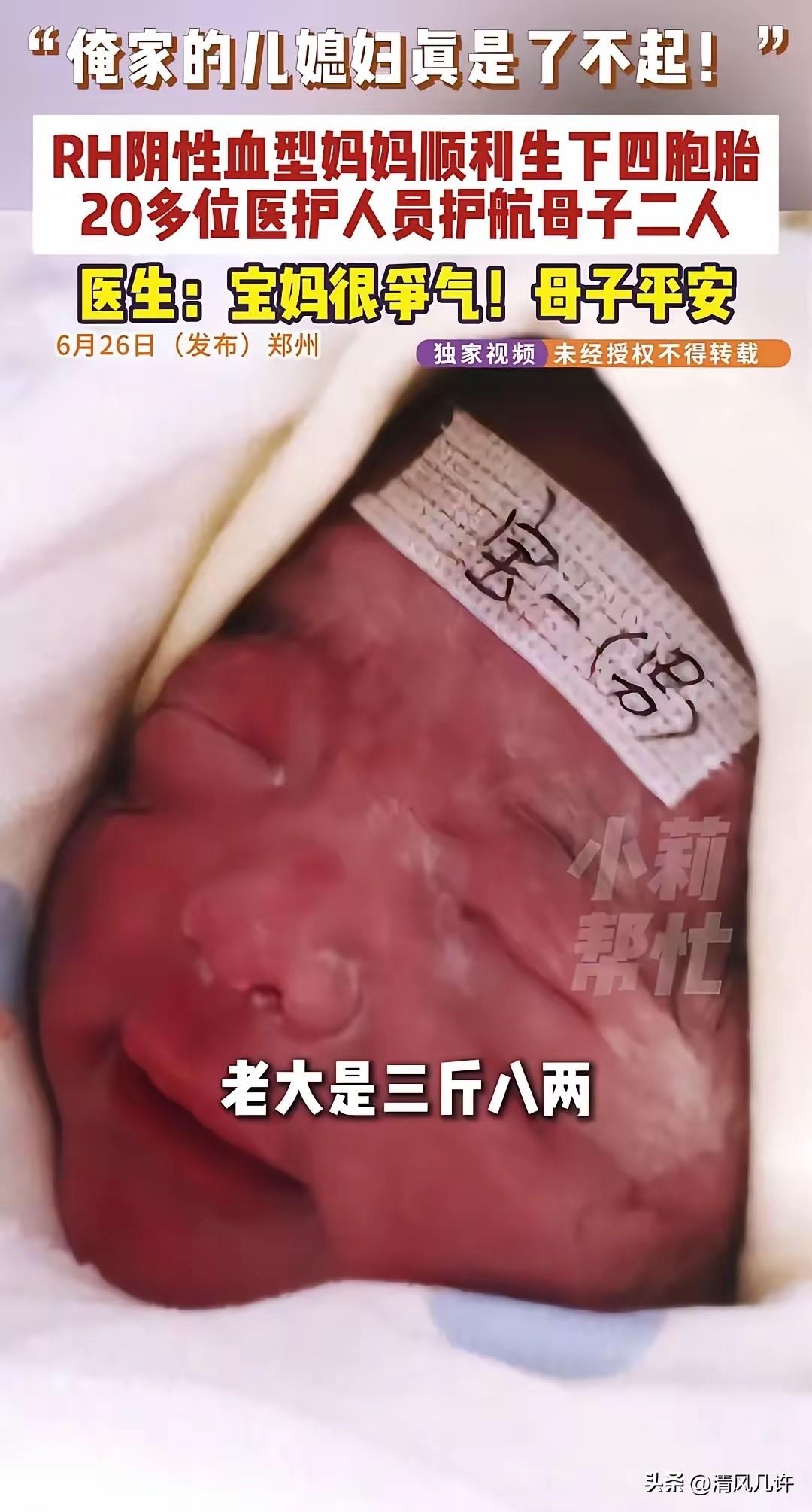 “太不容易了！”河南，一29岁产妇是Rh熊猫血，但是一怀就怀了四胞胎，产妇由10
