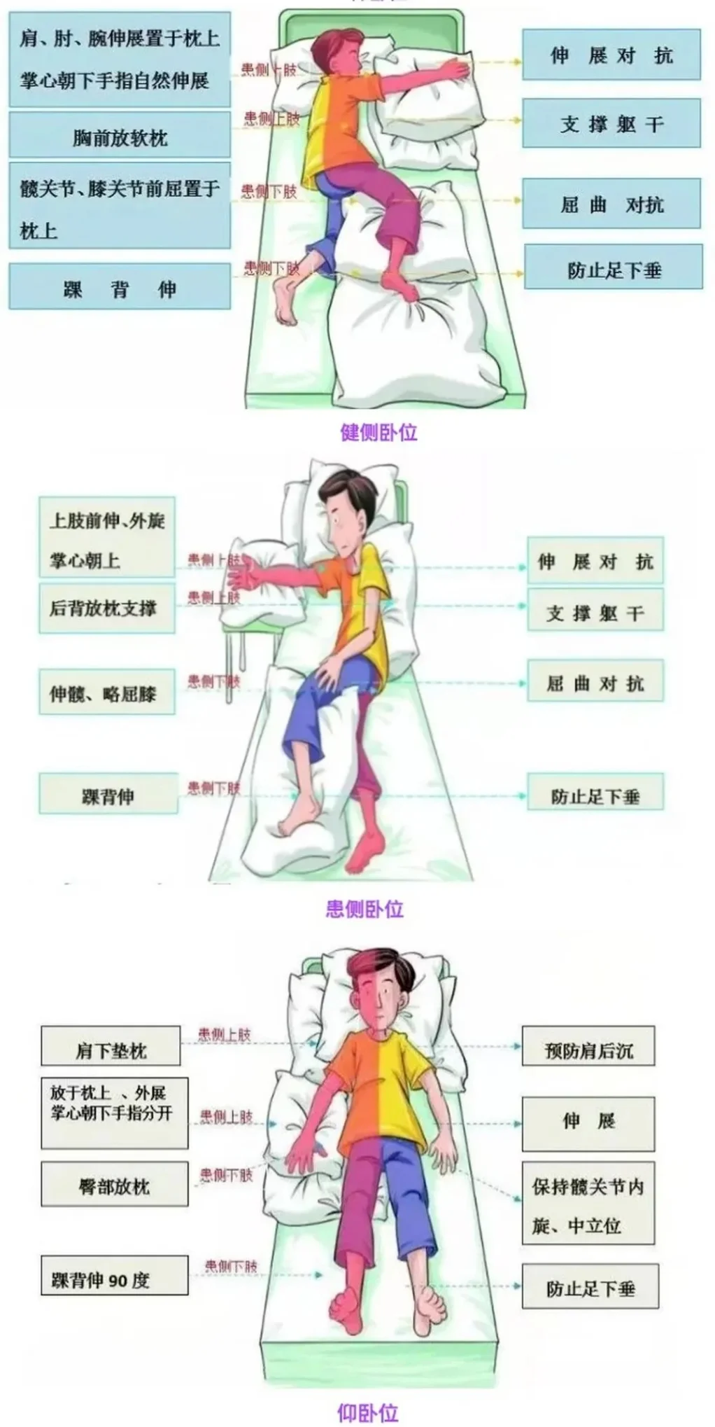 良肢位摆放