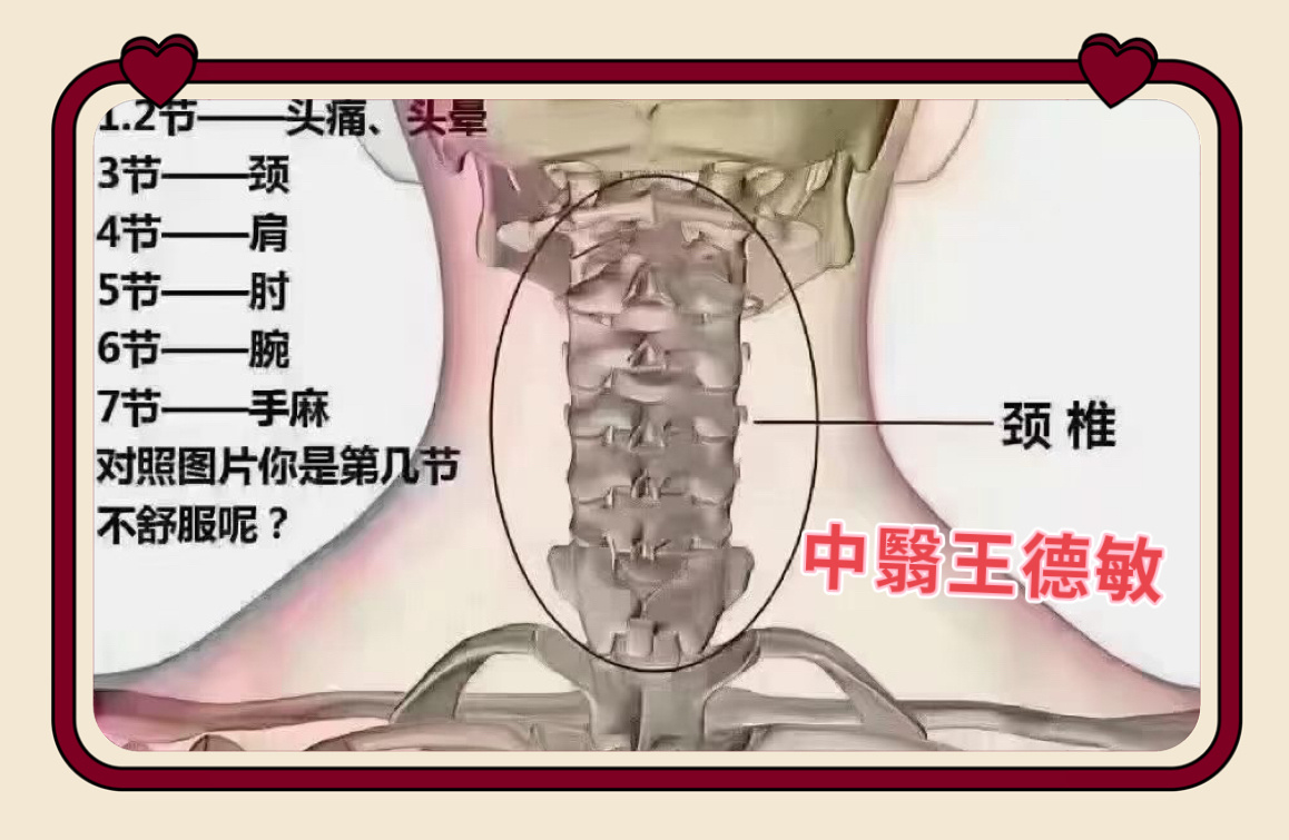 #中医##育儿专家说# 颈椎一共七节，颈①引起头晕头疼，颈②引起偏头疼、三叉神经