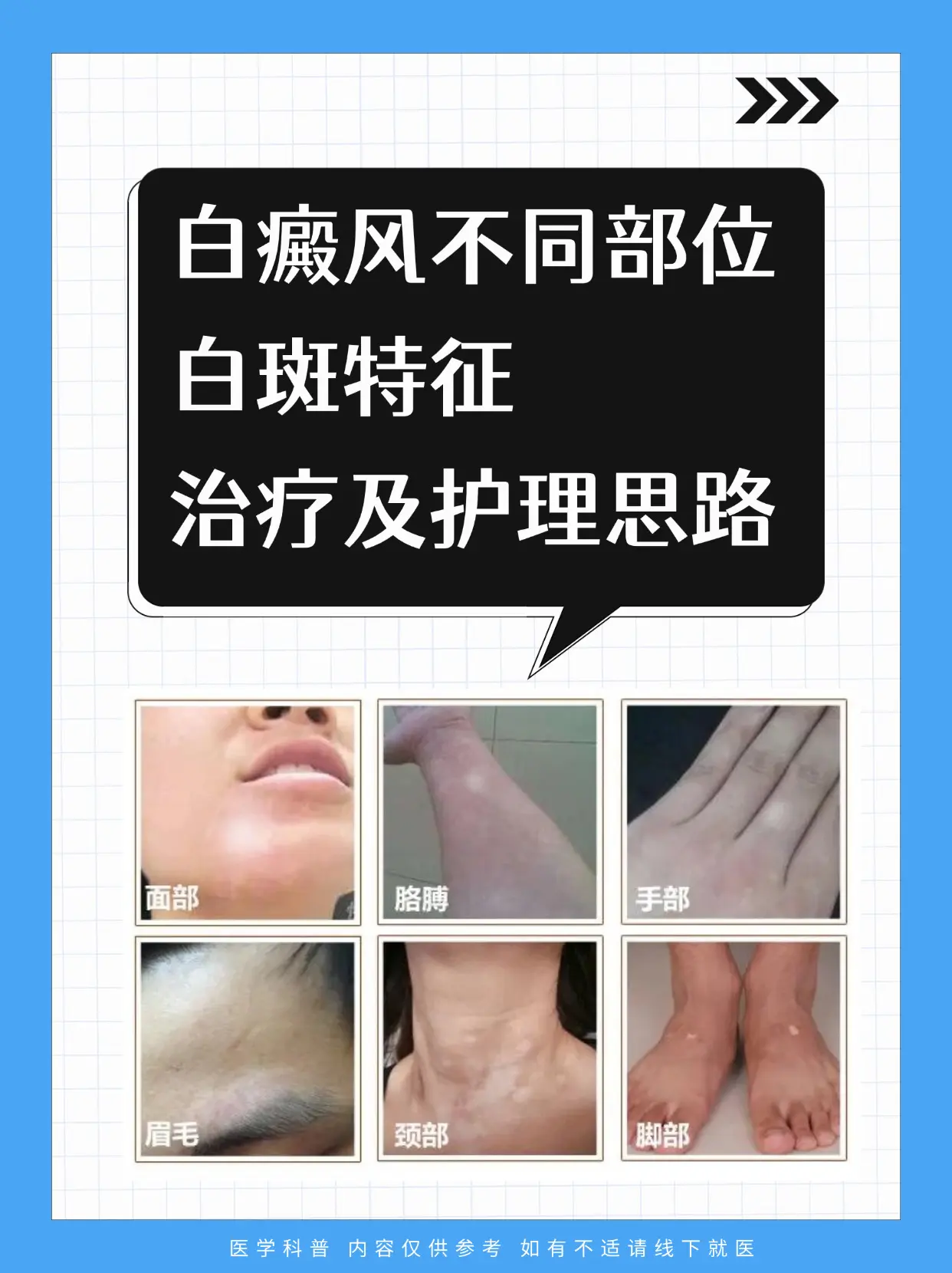 医学科普 白癜风 白癜风科普 白癜风患者 硬核健康科普行动