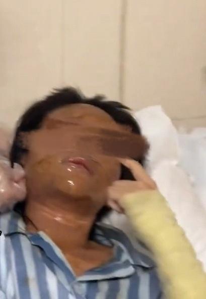 湖南一女主播收到炸弹包裹被炸伤10月16日，湖南29岁户外跳舞女主播称15日收到