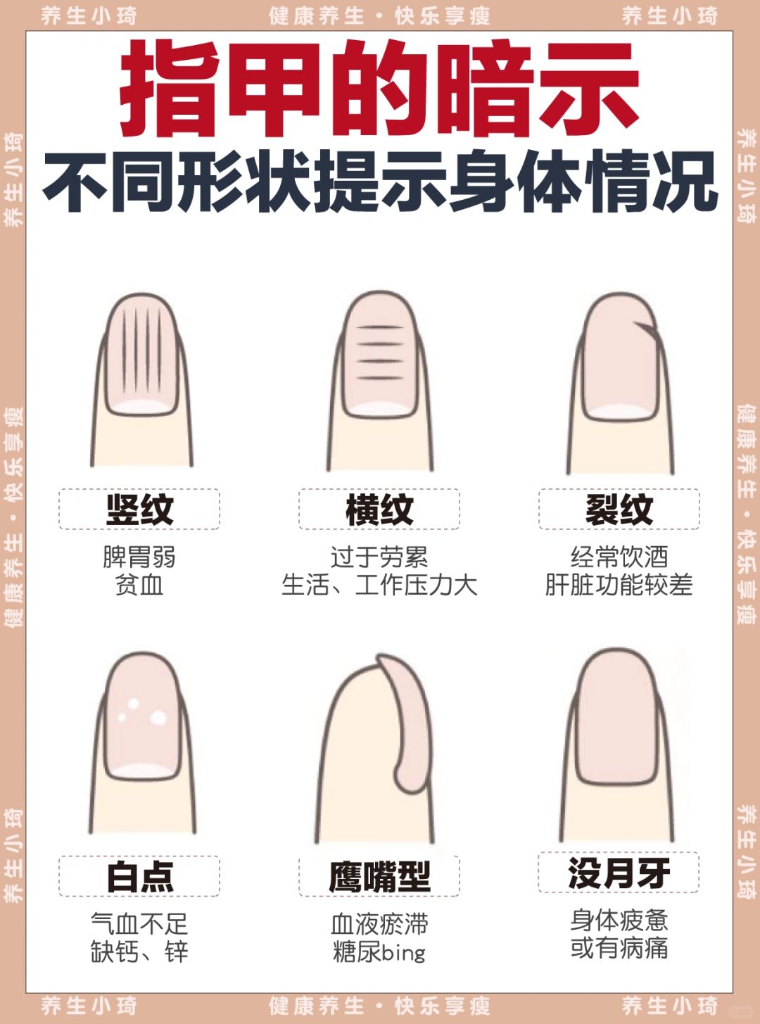 指甲的暗示｜从指甲纹路了解身体状况