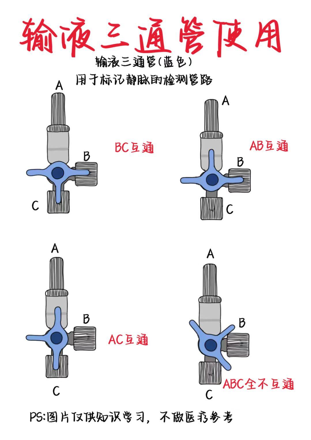 医学生笔记——输液三通管使用(蓝色)
