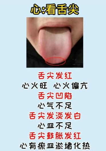 舌尖对应心、舌边对应肝，一张图看懂五脏状态