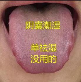 宗筋软，火气旺，湿热重！调理湿热型肾虚，这个思路一定要记住！
 
患者情况：今天