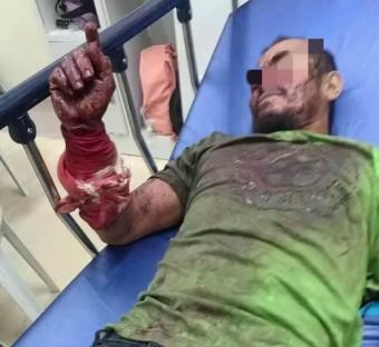 [啤酒]人被蟒蛇吞进肚子后，能不能用手里的刀逃出来？2014年，美国一位男子为了