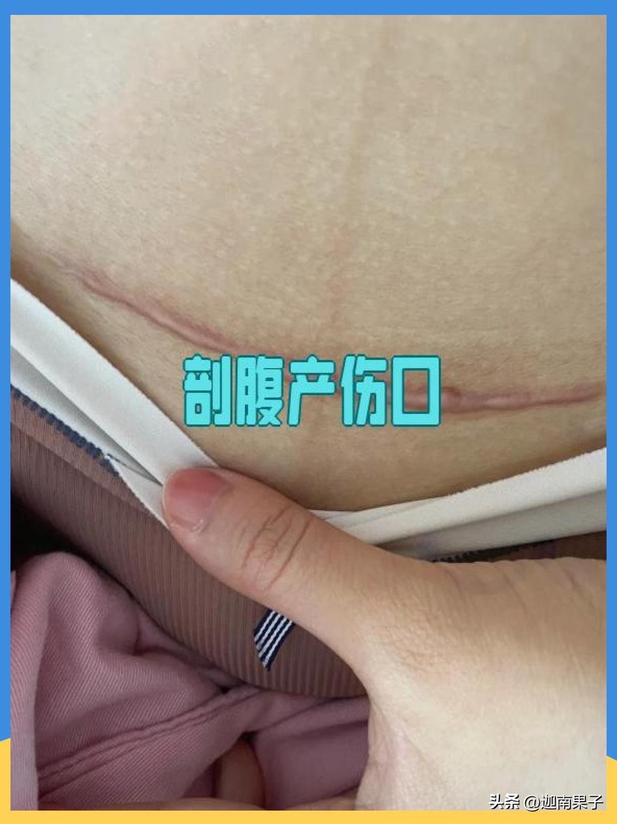 一位中医科医生说："凡是开刀剖腹产的女人，大多都气血空一半。女人顺产，是顺应自然
