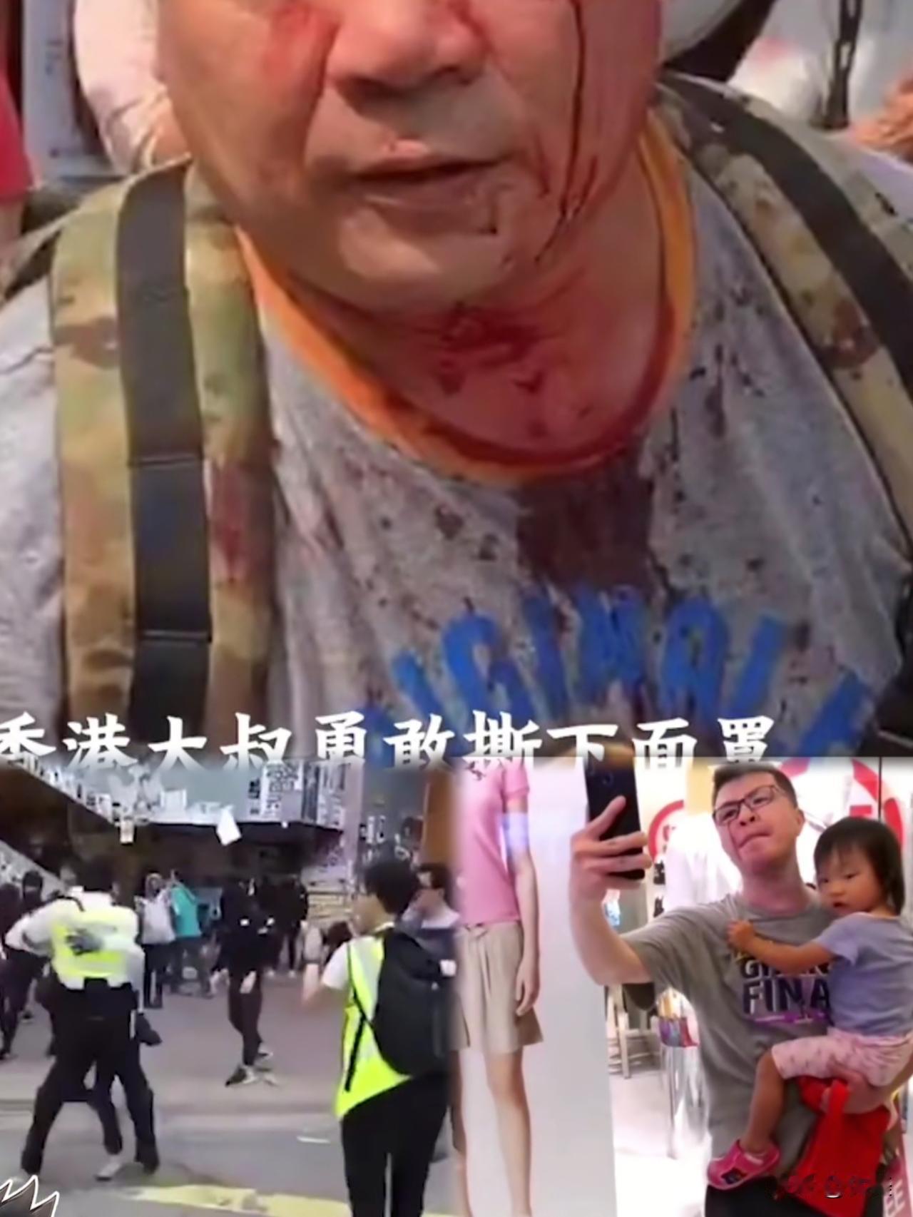 有谁能想到，五年前在旺角街头被暴徒围殴、缝了十一针的那个中年女人，如今在直播间里