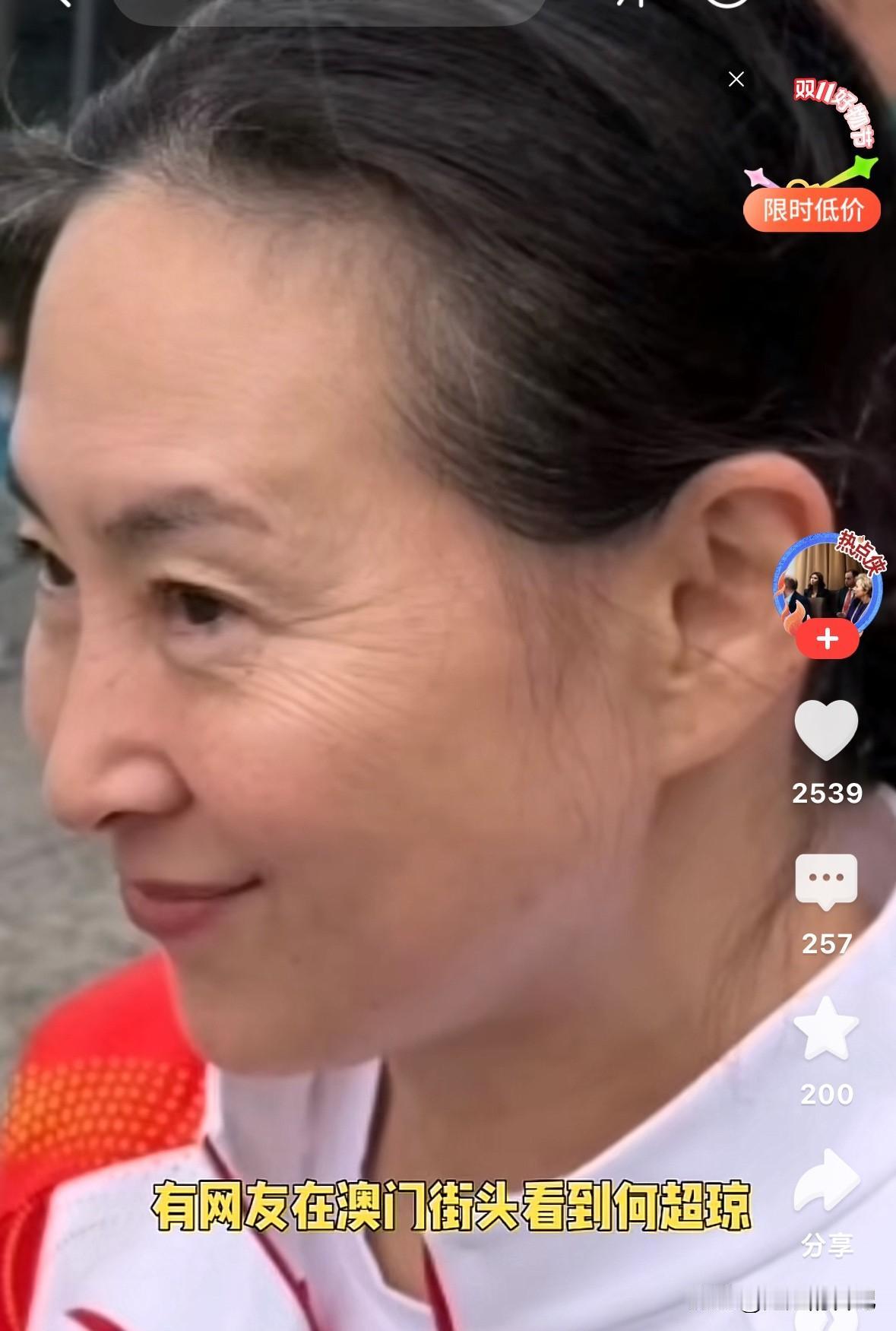 何超琼，满脸皱纹，但是皮肤特别好，一看就是保养出来的，但是，皮肤松弛，没有弹性，