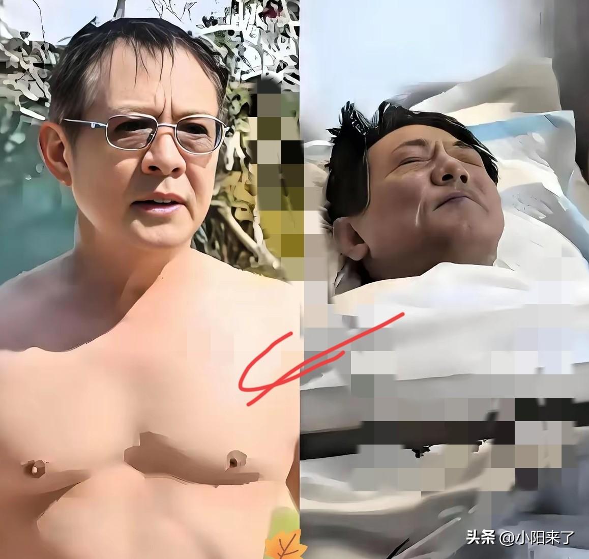 破案了！
​难怪李连杰一夜回春
​不是因为他做了什么手术，而是
​想把一个人拍老