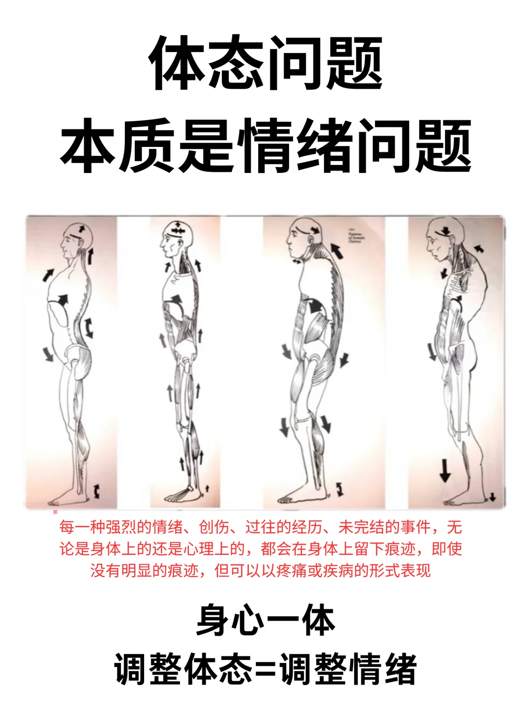 体态问题的本质是情绪问题
