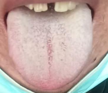 功能衰退、宗筋难举，为啥补肾反而没效果？






很多朋友一遇见功能问题就认