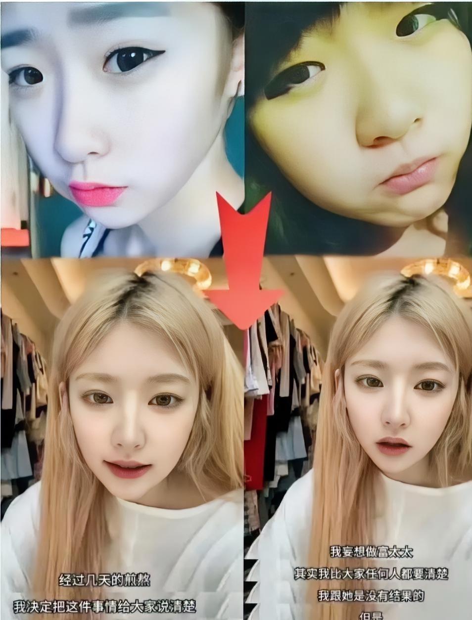 黄一鸣整容对比图太绝了！脸小一圈直接美成女神
 
刷到黄一鸣整容对比图真的被惊到