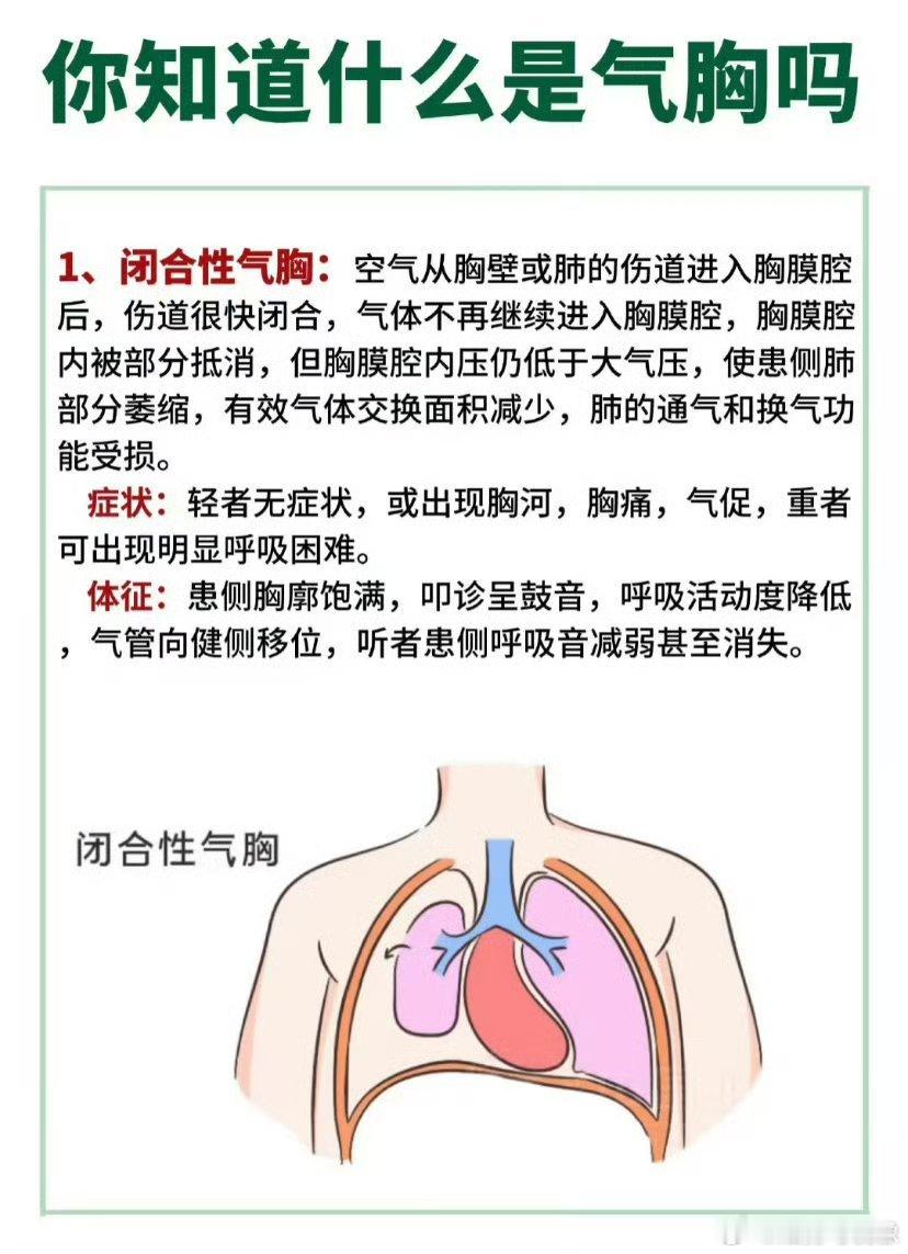 为什么高瘦男性容易得气胸 气胸虽可通过治疗控制，但反复发作可能对健康造成长期影响