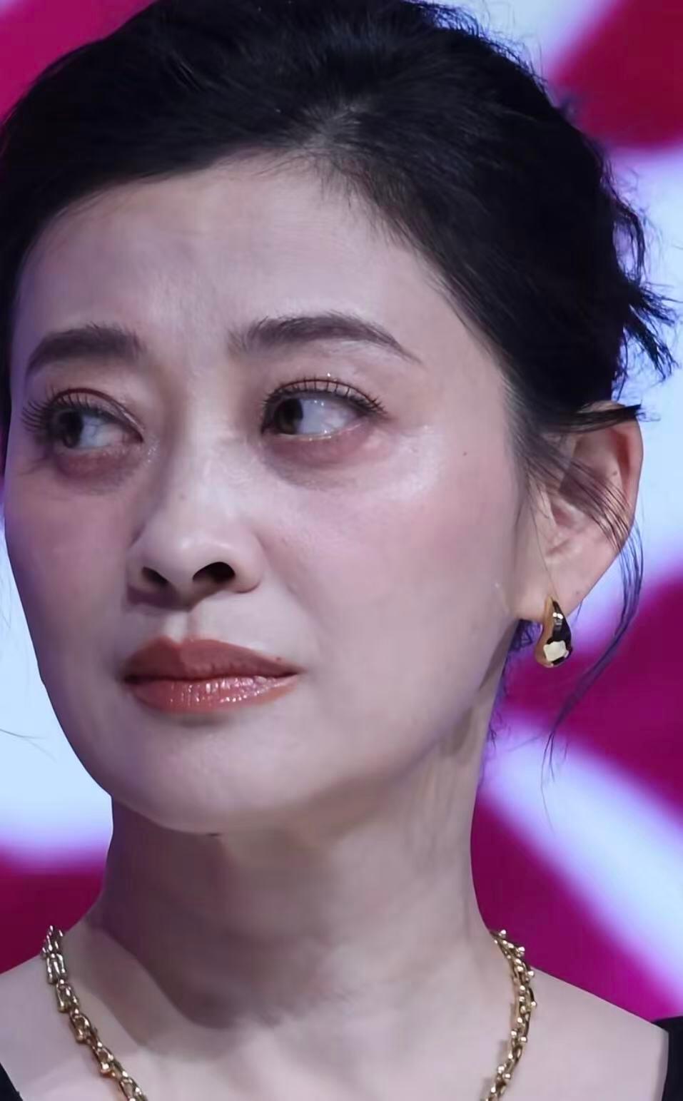 她眼下是卧蚕还是眼袋？ ​​​