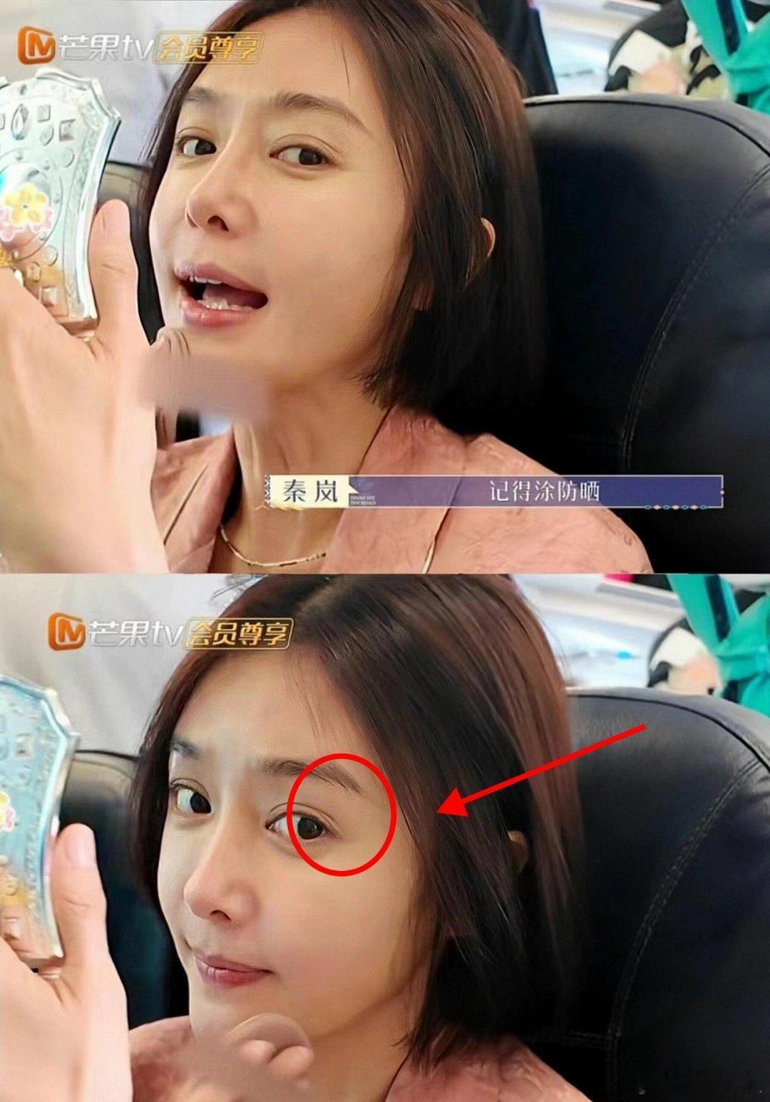 她的眼尾这里双眼皮为啥分开了。 ​​​