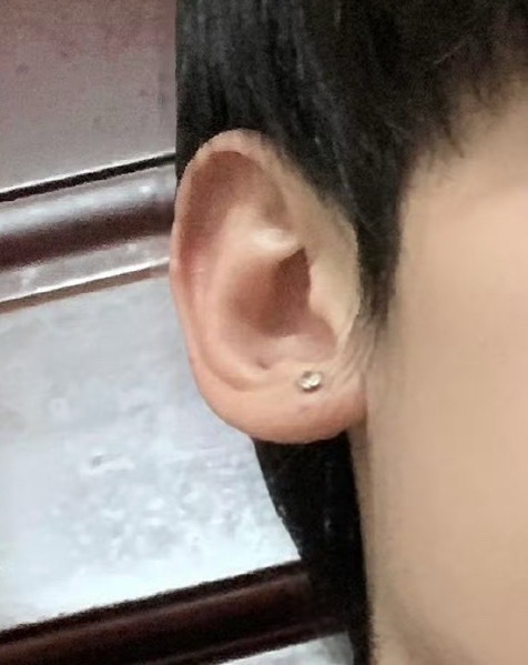 果然还是怕痛啊哈哈哈哈哈 