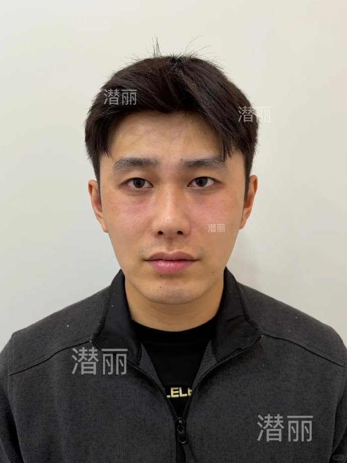 万宁叔整容凭借搞笑视频和五子棋梗爆红的万宁叔，近期因容貌变化陷整容争议，侧颜线条