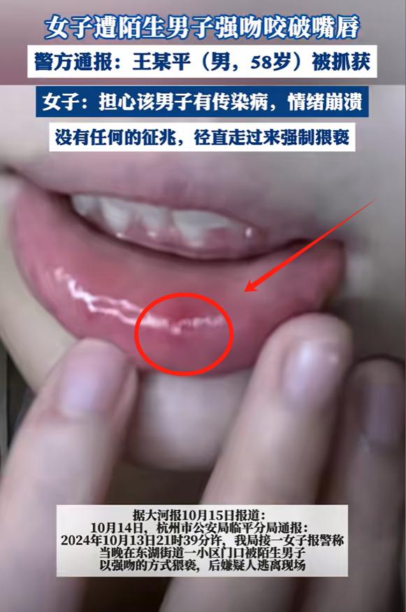 太恶心了！浙江杭州，58岁的男子饥渴难耐，强吻街边女子，还咬破她下嘴唇，女子抓住