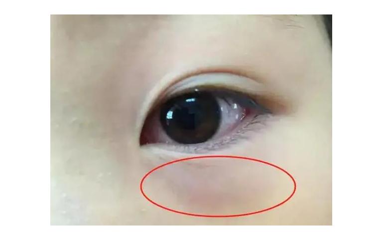 孩子鼻炎就是脾胃太“热”了，白萝卜加它煮水喝，灭了脾胃的火，鼻炎跟着也好了！
