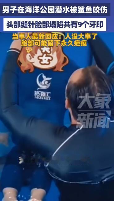 太糟心了！长沙的包先生花了480体验潜水，谁曾想在海洋公园被鲨鱼咬了，脸上头上全