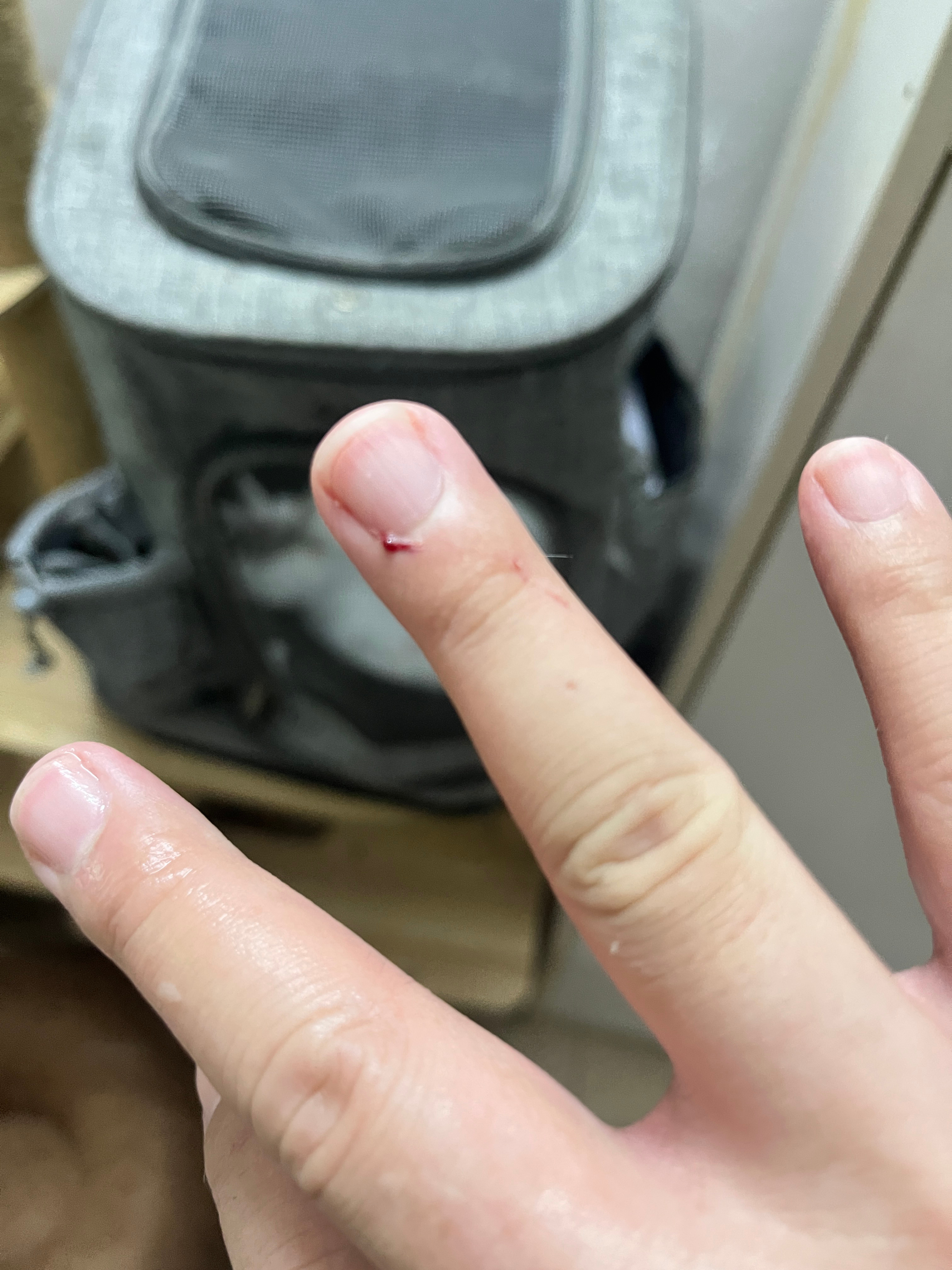 我今天早上把这家伙放回大自然了，给我干了一个需要缝针级别的撕裂性开放创口出来了…