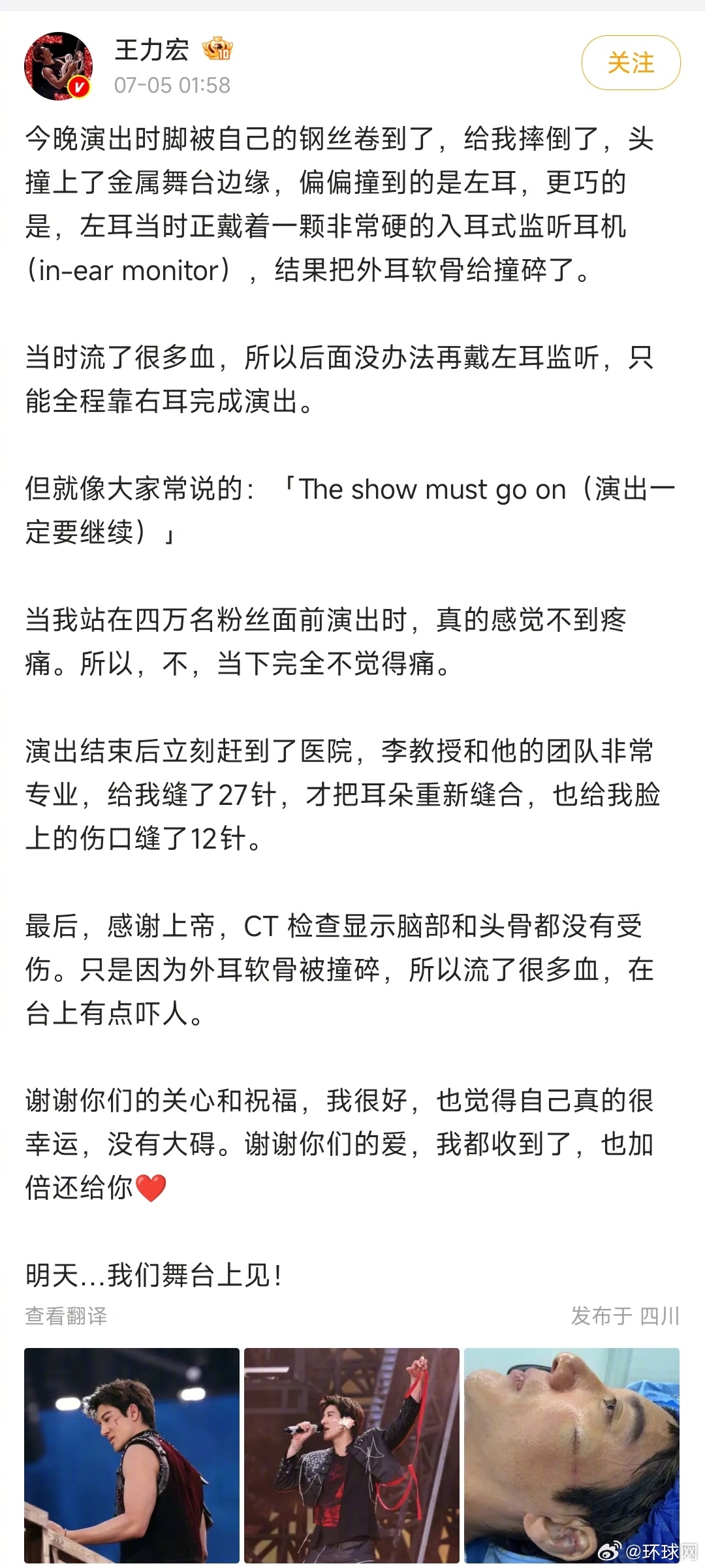【#王力宏回应伤情##王力宏说舞台见#】7月5日凌晨，发博回应此前受伤情况: 演