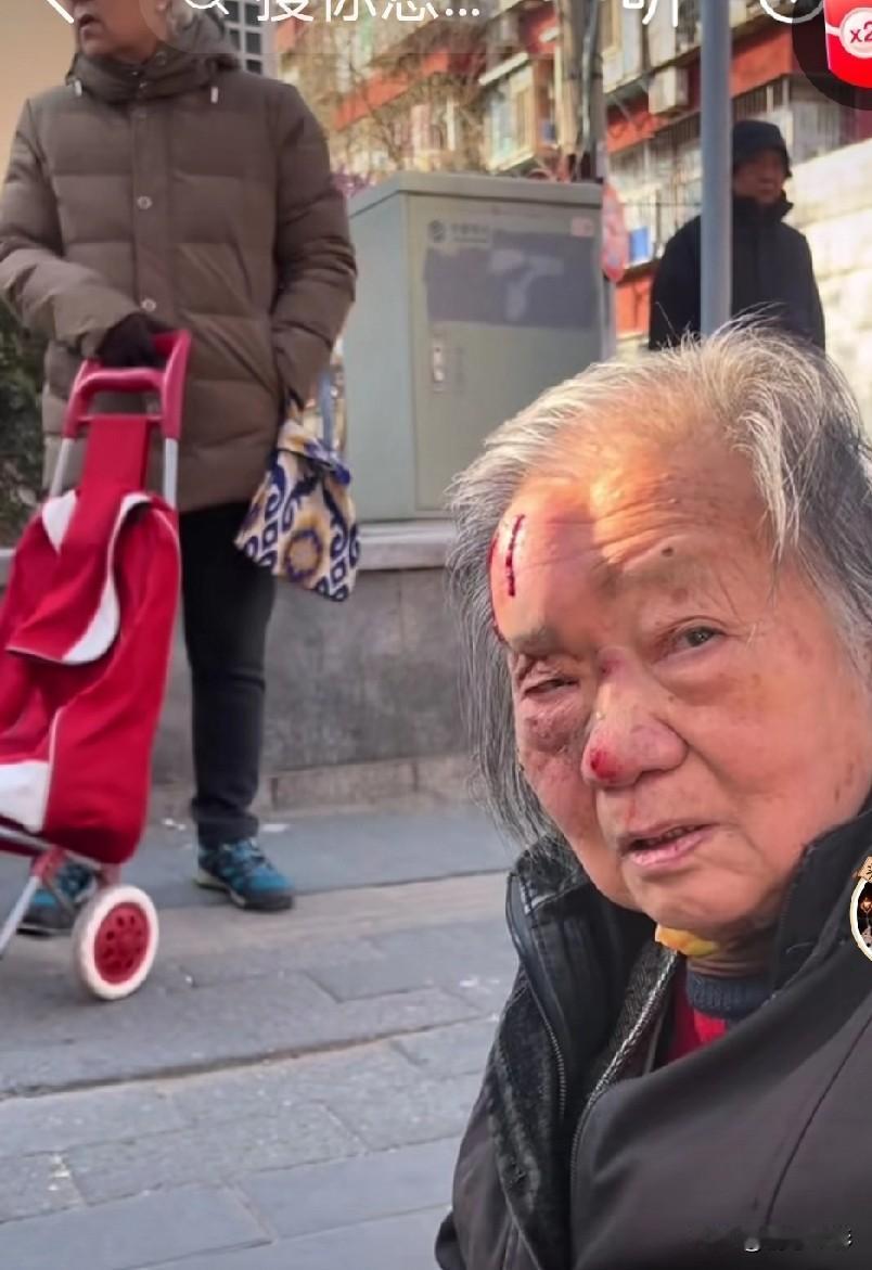 不得不感叹人老了就是一场腥风血雨，看看这老奶奶摔成什么样了。

一位80多岁的老